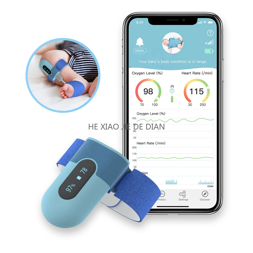 Wellue BabyO2 Smart Sock Baby Pulse Oximeter Bluetooth